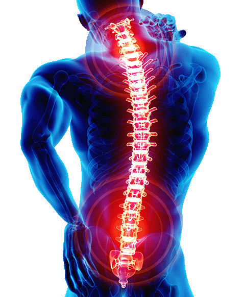 A back pain relief illustration showing the pains in the back.
